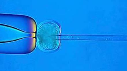 Die Entscheidung des Europäischen Gerichtshofs zur Stammzellenforschung hat weitreichende Konsequenzen.