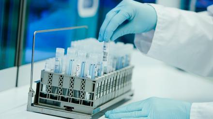 PCR-Teströhrchen in den Händen eines Labor-Mitarbeiters - in Potsdam wie in ganz Brandenburg gehen die Inzidenzzahlen deutlich zurück. 