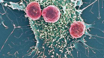 Krebszelle, die von Killerzellen angegriffen wird