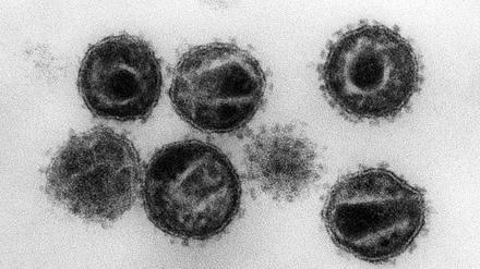 Eine elektronenmikroskopische Aufnahme zeigt mehrere Humane Immunschwäche-Viren (HIV).