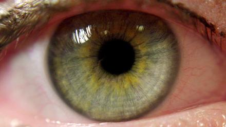 Das Auge einer Frau mit Synästhesie (Sinnesvermischung) in der Universitätsklinik Frankfurt am Main.
